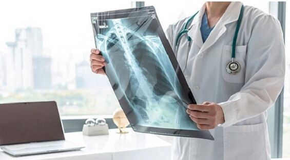 Rentgenska diagnostika bolečine pod levo lopatico