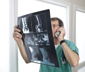 Mielografija za diagnozo osteohondroze in medvretenčne kile