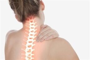 Cervikalna osteohondroza pri ženskah